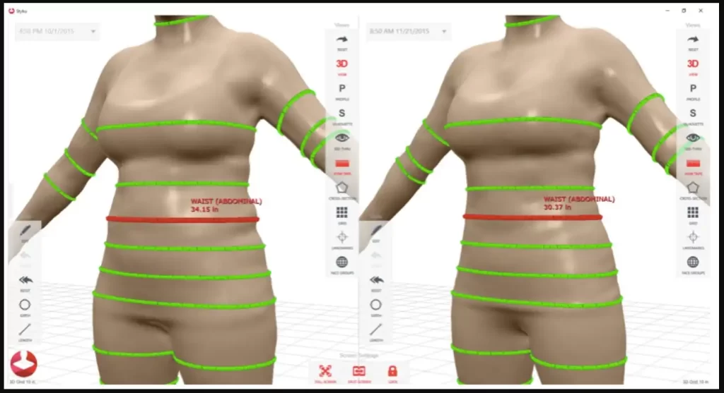 3D Body Scan